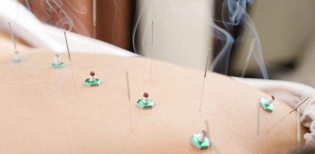 背中の施術と全身治療