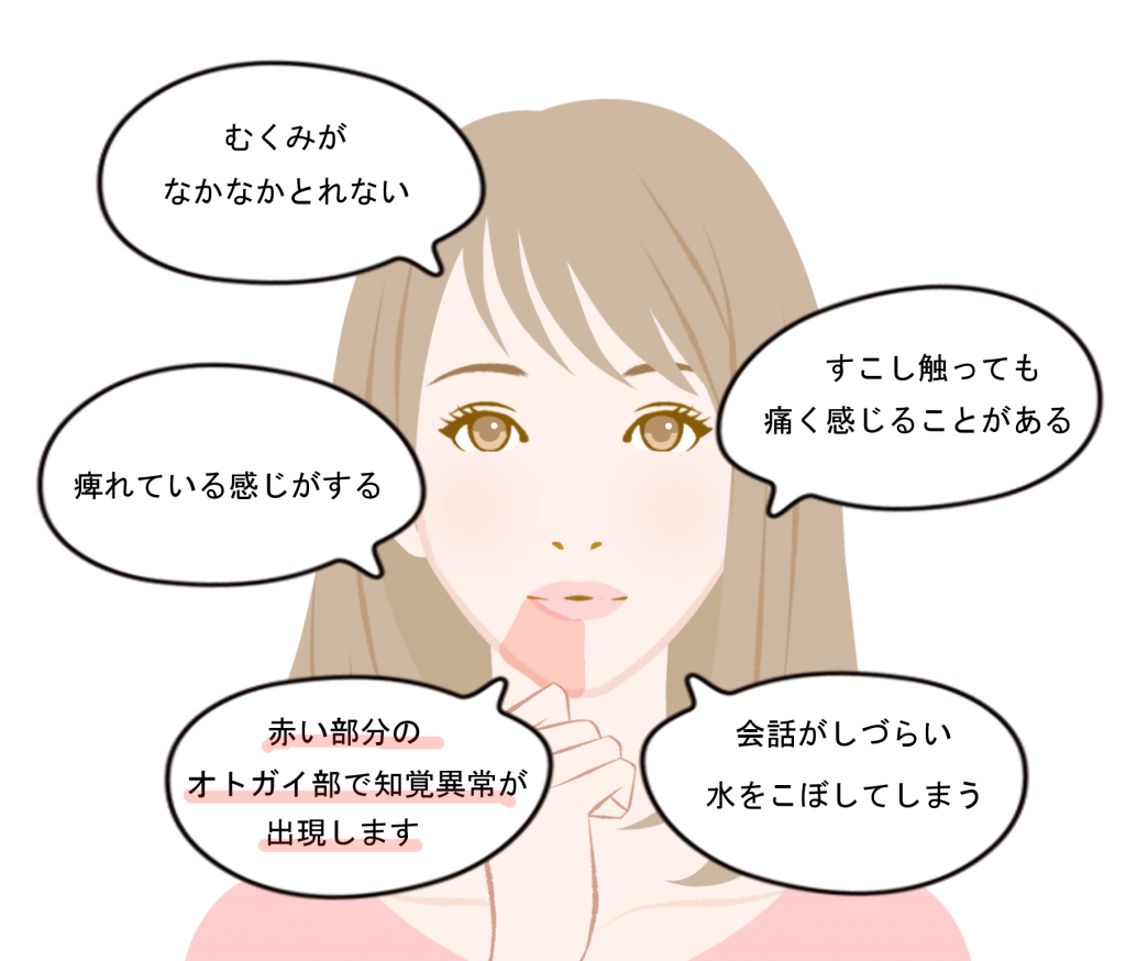 下歯槽神経麻痺の症状